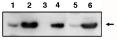 "
Western blot using
anti-PIG3 antibody on
RKO cells transfected
with pCEP4 without insert (1), transfected with
pCEP4-PIG3 (2), under
control conditions (3) and
treated with adriamycin to
activate wild-type p53
(4). Also used on MCF-7 cells transfected with pCEP4 without insert (5) and pCEP4-PIG3 (6)."